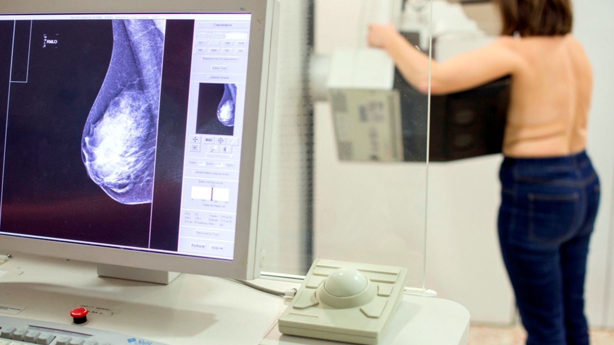 Una dona es fa una mamografia per detectar si té càncer de mama en una imatge d'arxiu / Foto: ACN