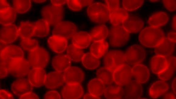 L'hemoflia dificulta la coagulaci de les persones que la pateixen // Foto: Commons